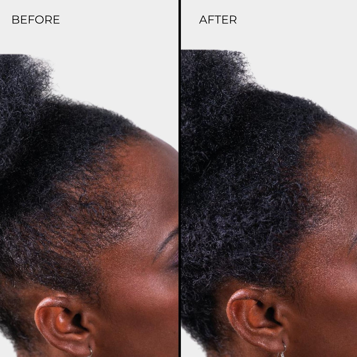 Nanogen Hair Thickening Fibre Black