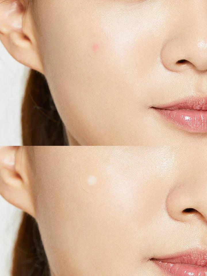 COSRX Acne Pimple Master Patch 24pcs