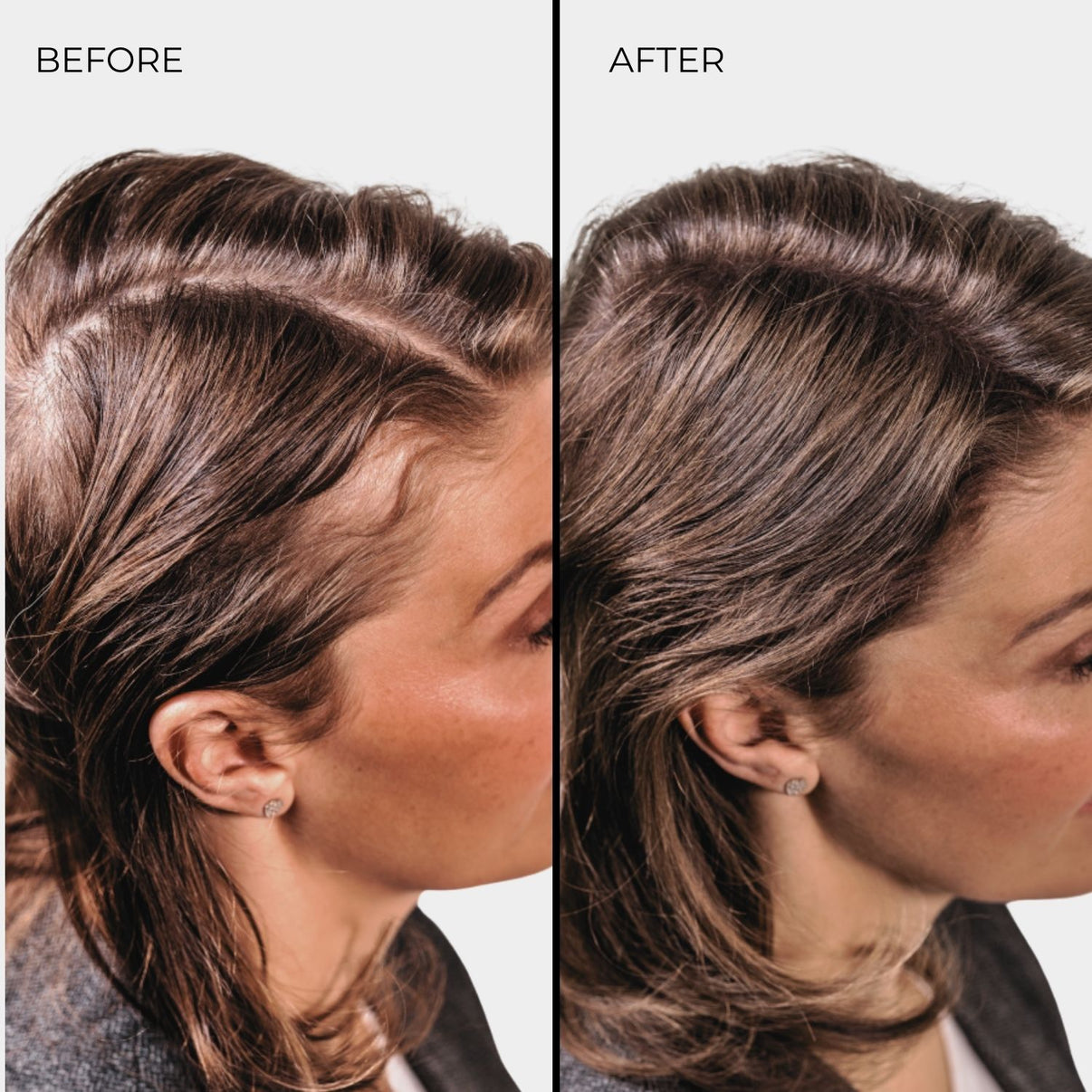 Nanogen Hair Thickening Fibre Light Brown 15g